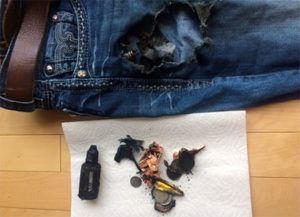 a jeans was burnt due to users storing vape battery together with metals in the pocket